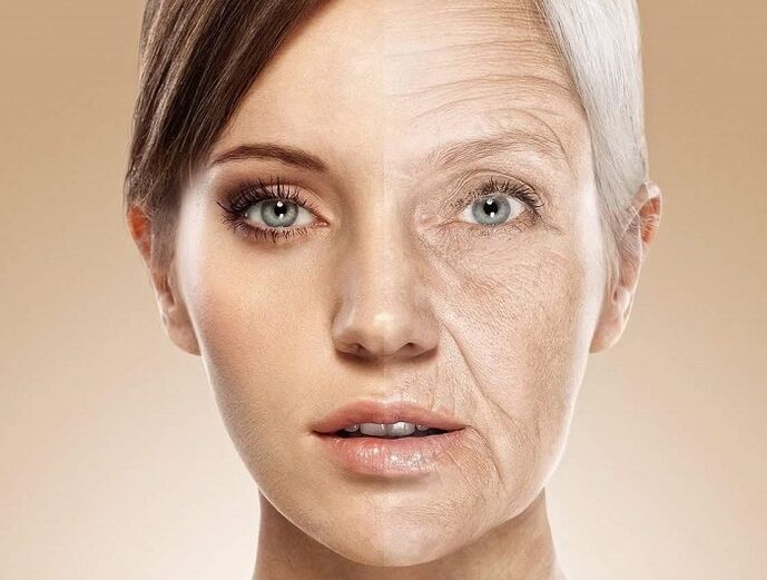 դեմքի մաշկը լազերային երիտասարդացումից առաջ և հետո